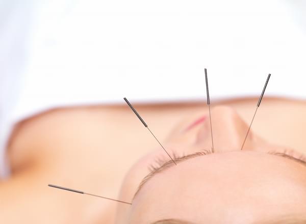 Acupuncture at Sea on Celebrity Equinox